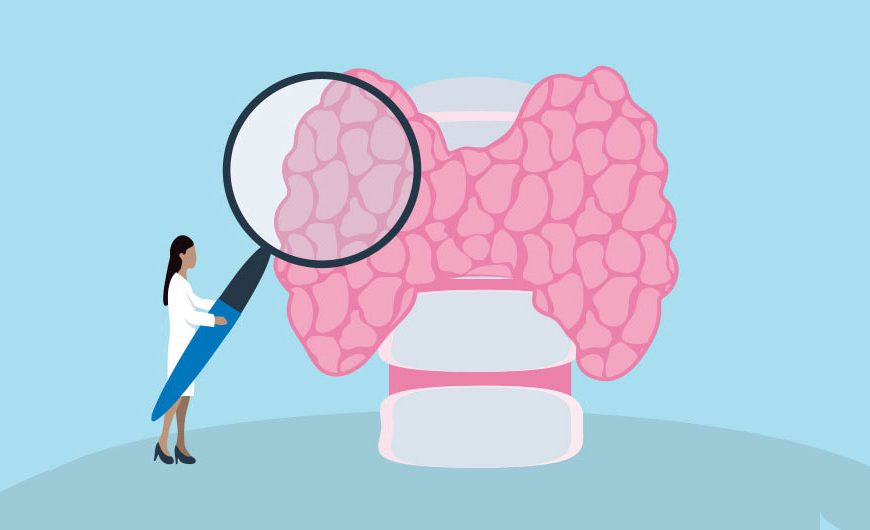 How to check if your Thyroid Glad is Working Properly