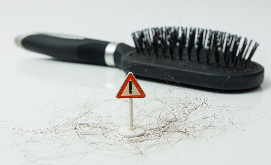 Hair Loss Home Remedies