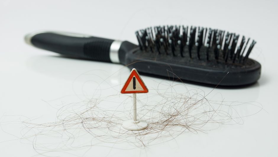 Hair Loss Home Remedies