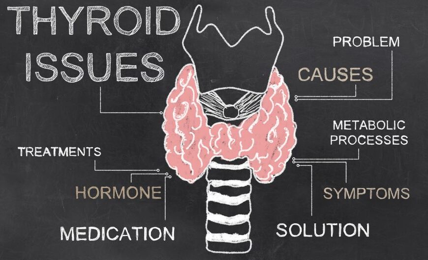 Thyroid Home Remedies