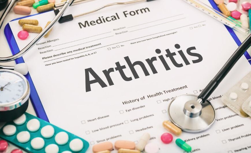 Home Remedies to Decrease Arthritis Impact