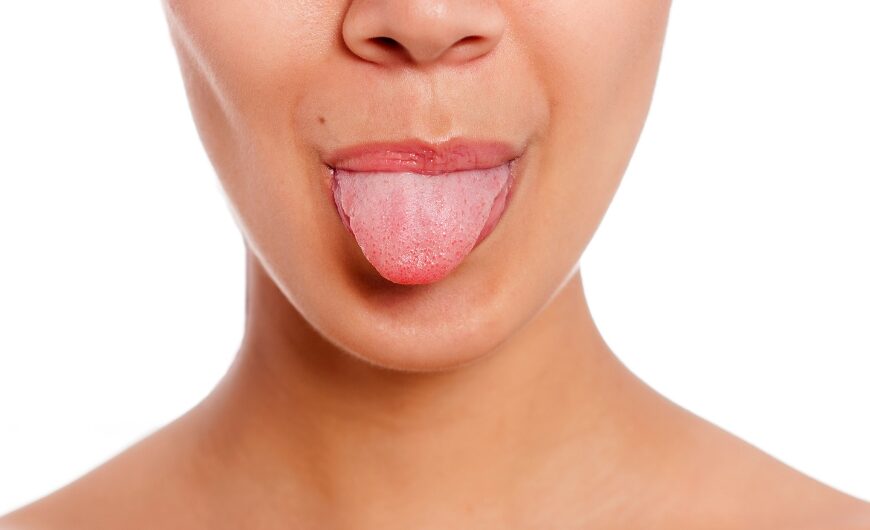 Ayurveda Tongue Diagnosis Based on Tri Doshas