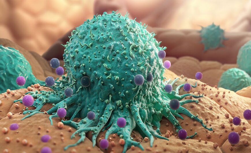 Natural Cancer Healing