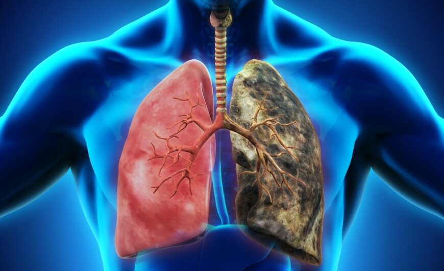 How Living in India Affects Your Lungs