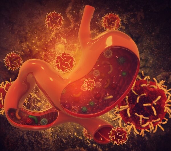 Your Gut Damage Started Years Ago