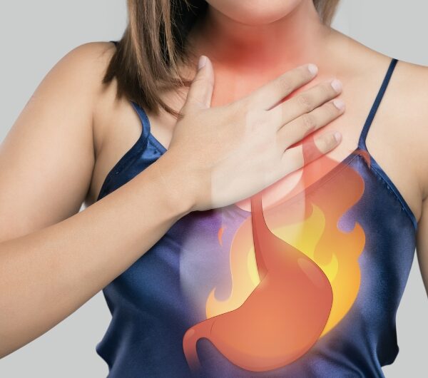 Root Cause of Acid Reflux