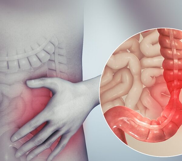 The main cause of your diarrhea isn’t food poisoning