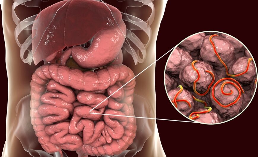 5 Surprising Facts About Parasites