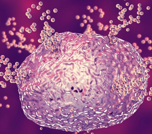 How Histamine Overload Is Triggering Your Health Issues