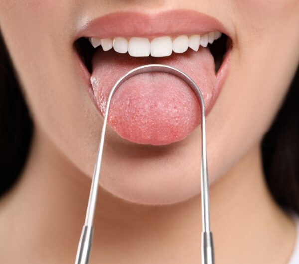 Ayurveda Says Tongue Coating Reveals Ama Levels