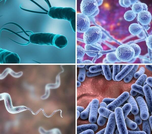 4 Infections Linked with Chronic Gut Issues